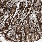 RFX5 Antibody in Immunohistochemistry (Paraffin) (IHC (P))