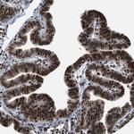 RFX5 Antibody in Immunohistochemistry (Paraffin) (IHC (P))
