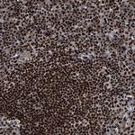 RFX5 Polyclonal Antibody