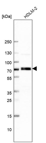 RFX5 Antibody in Western Blot (WB)