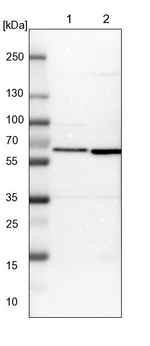 TCP-1 theta Antibody in Western Blot (WB)