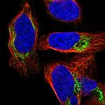 NDUFS8 Polyclonal Antibody