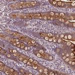 Annexin A13 Antibody in Immunohistochemistry (IHC)