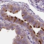 Annexin A13 Antibody in Immunohistochemistry (IHC)