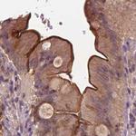 Annexin A13 Antibody in Immunohistochemistry (IHC)
