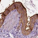 Annexin A13 Antibody in Immunohistochemistry (IHC)