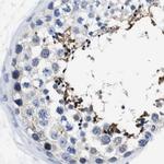 HOOK1 Antibody in Immunohistochemistry (Paraffin) (IHC (P))