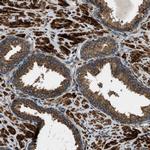 ERGIC1 Antibody in Immunohistochemistry (IHC)