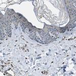 ERGIC1 Antibody in Immunohistochemistry (IHC)