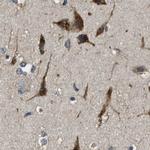 ERGIC1 Antibody in Immunohistochemistry (IHC)