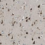 ERGIC1 Antibody in Immunohistochemistry (IHC)