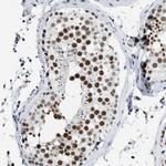 SFRS15 Antibody in Immunohistochemistry (Paraffin) (IHC (P))