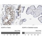 SFRS15 Antibody in Immunohistochemistry (IHC)