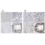 SFRS15 Antibody in Immunohistochemistry (IHC)
