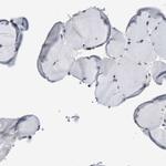 SFRS15 Antibody in Immunohistochemistry (IHC)