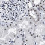 SFRS15 Antibody in Immunohistochemistry (IHC)
