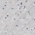SFRS15 Antibody in Immunohistochemistry (IHC)