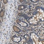 BCL7C Polyclonal Antibody