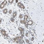 MRPS30 Antibody in Immunohistochemistry (IHC)