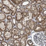 MRPS30 Antibody in Immunohistochemistry (IHC)