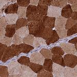 ST3GAL6 Antibody in Immunohistochemistry (Paraffin) (IHC (P))