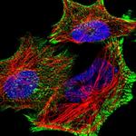 PDLIM7 Polyclonal Antibody