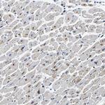 PDLIM7 Antibody in Immunohistochemistry (IHC)