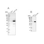 PDLIM7 Antibody in Western Blot (WB)