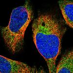 CHKB Antibody in Immunocytochemistry (ICC/IF)
