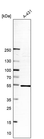 NLE1 Antibody in Western Blot (WB)