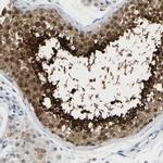 TXNDC2 Antibody in Immunohistochemistry (IHC)