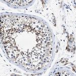 HOOK1 Antibody in Immunohistochemistry (Paraffin) (IHC (P))