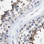 HOOK1 Polyclonal Antibody