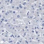 HOOK1 Antibody in Immunohistochemistry (IHC)