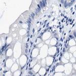 HOOK1 Antibody in Immunohistochemistry (IHC)