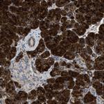 ZNF70 Antibody in Immunohistochemistry (Paraffin) (IHC (P))