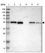 ZNF70 Antibody in Western Blot (WB)