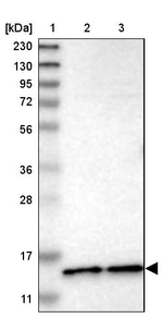 CDPF1 Antibody in Western Blot (WB)