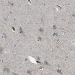 SLC43A1 Antibody in Immunohistochemistry (IHC)