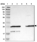 FNTA Antibody in Western Blot (WB)