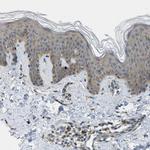 EDARADD Antibody in Immunohistochemistry (IHC)