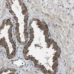 EDARADD Antibody in Immunohistochemistry (IHC)