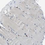 EDARADD Antibody in Immunohistochemistry (IHC)