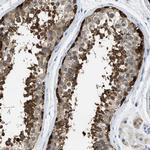 TOMM34 Antibody in Immunohistochemistry (IHC)