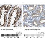 TOMM34 Antibody