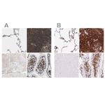 EVL Polyclonal Antibody