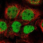 GPATCH2L Polyclonal Antibody