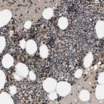 GPATCH2L Antibody in Immunohistochemistry (Paraffin) (IHC (P))