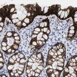 A33 Antibody in Immunohistochemistry (Paraffin) (IHC (P))