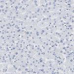 A33 Antibody in Immunohistochemistry (Paraffin) (IHC (P))